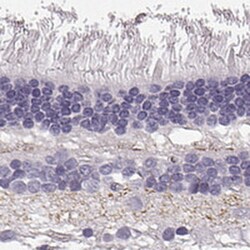 SLC1A7 Antibody, Novus Biologicals:Antibodies:Primary Antibodies